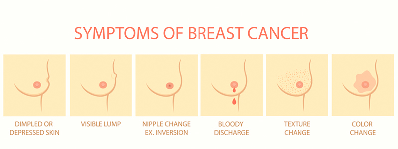 breast cancer image | Arizona Advanced Surgery