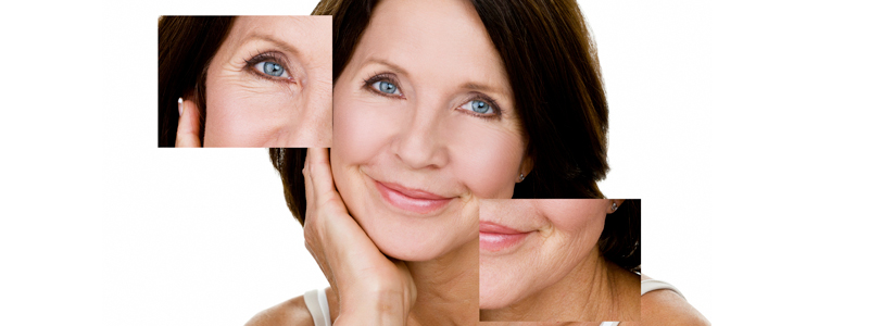 Rhytidectomy (Facelift) Image | Arizona Advanced Surgery