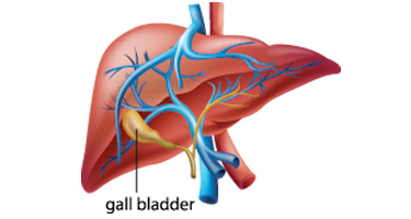 Laparoscopic Cholecystectomy, Gallbladder Surgery Image | Arizona Advanced Surgery